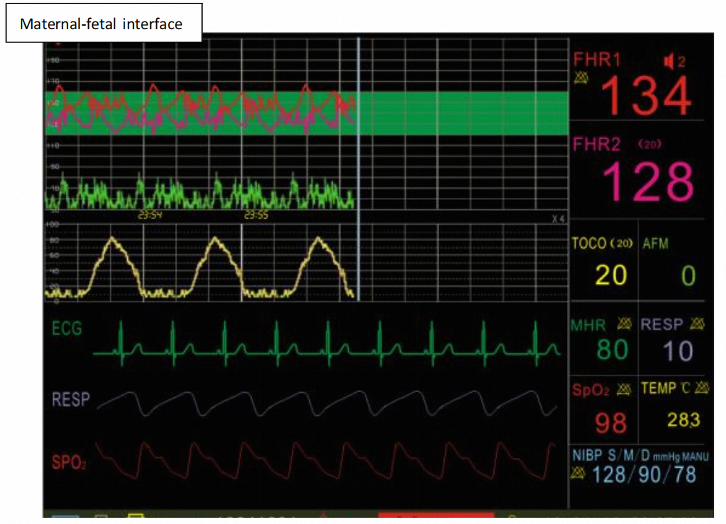 Portable CTG Fetal Monitor Machine with 12.1 factory