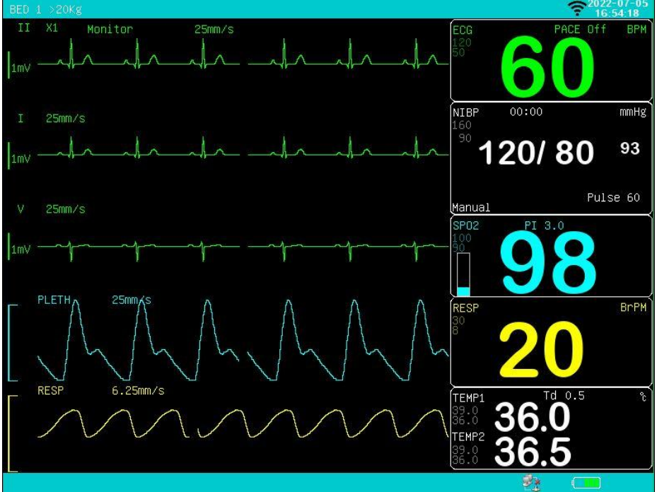 15'' good price patient monitor with stand icu monitor manufacture