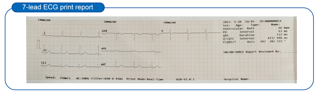 2024 hot selling 3-Channel 12-Lead Portable ECG Machine Animal Veterinary Medicine EKG Device for Veterinary Instrument Use supplier