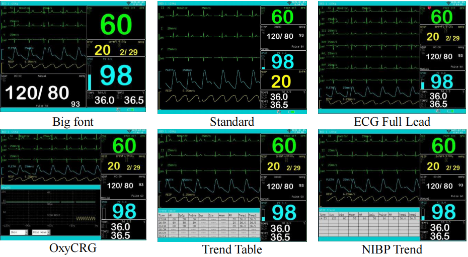 15'' good price patient monitor with stand icu monitor factory