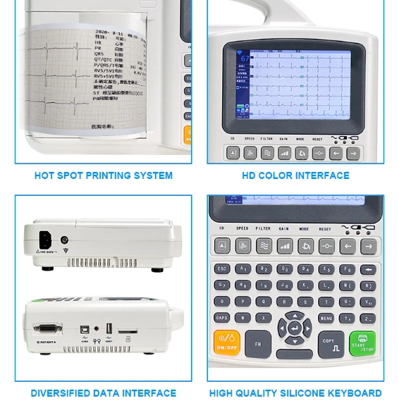 2024 hot selling 3-Channel 12-Lead Portable ECG Machine Animal Veterinary Medicine EKG Device for Veterinary Instrument Use manufacture