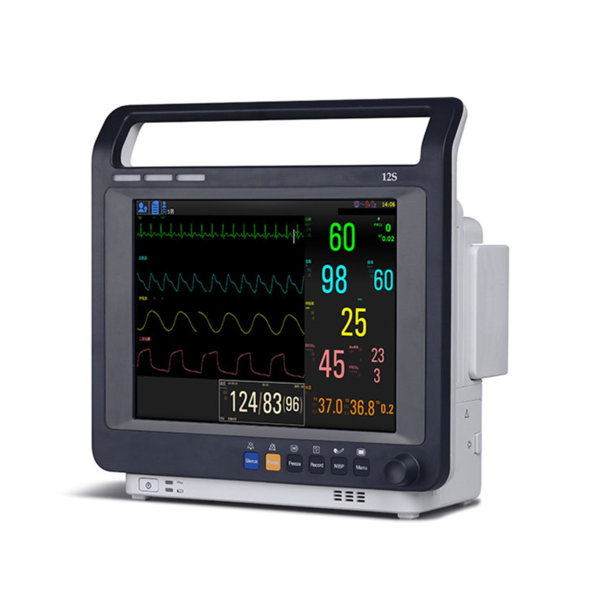 XHE-11 Monitè Sante Integre