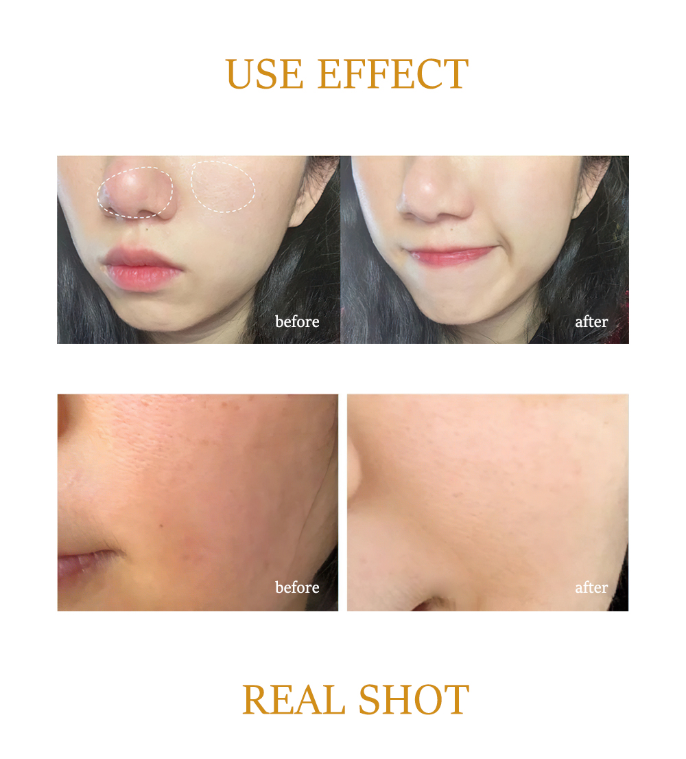 Anti Time Serum Capsules factory