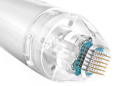 Latest Trends in Fractional MTS Technology: From Scarlet SRF to Vivace RF