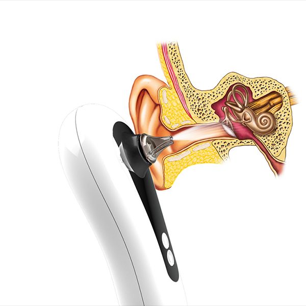 الابتكار في سماع البلوتوث