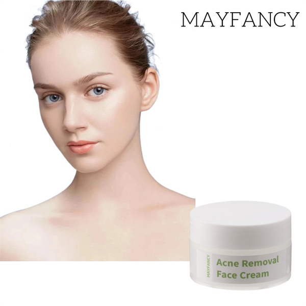 Say Goodbye to Dry Skin with our Moisturizing Cream