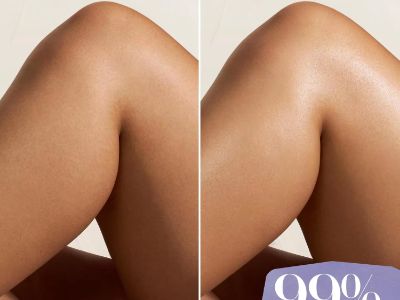 Why moisturizer is essential in daily skincare routines