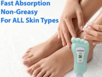 How foot crack cream improves cracked heel recovery speed