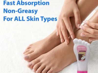 Latest Trends in foot crack cream therapeutic skincare