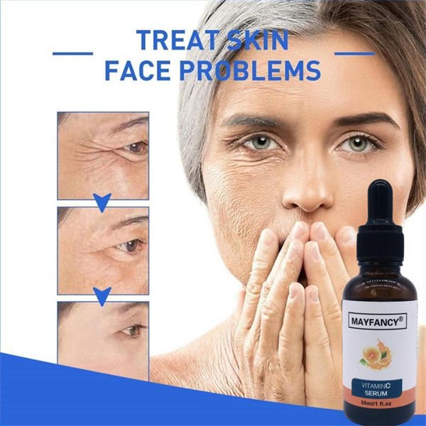 Experience The Power of Vitamin C for Better Skin with Our Serum Solutions
