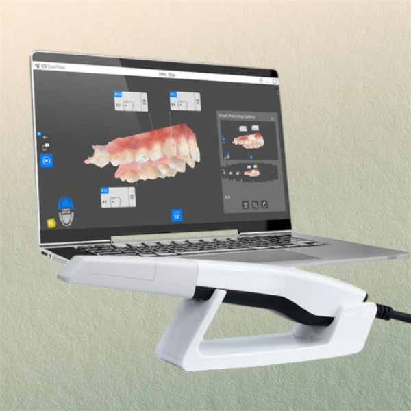 How Dental Scanners Improve Workflow in Your Dental Office