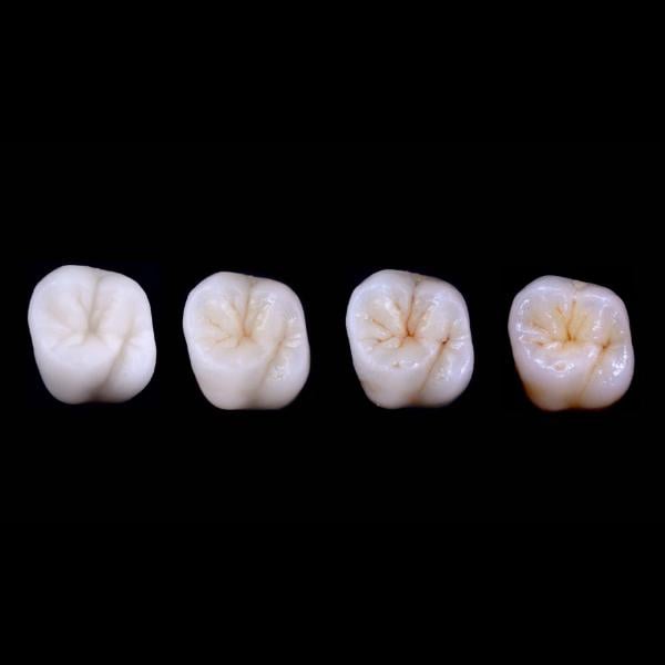 Understanding the technology behind multilayer zirconia and its applications in dentistry.