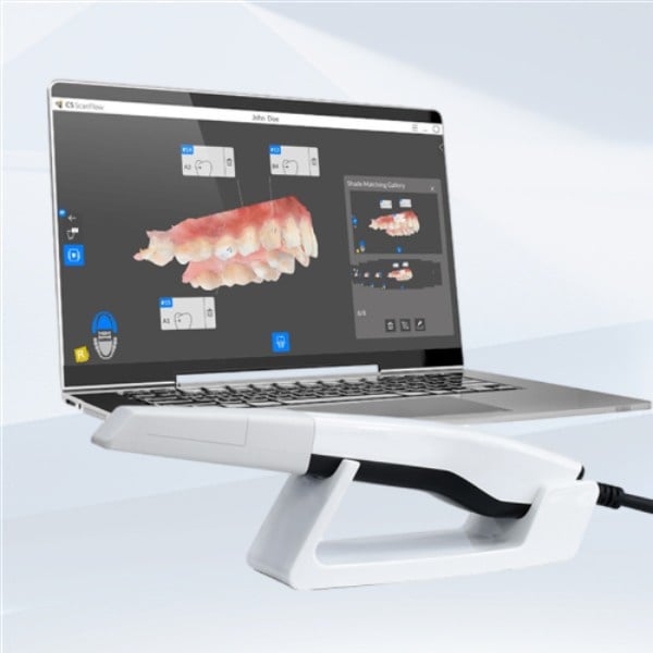 چه ویژگی‌هایی در یک اسکنر داخل دهانی قابل حمل با کیفیت بالا باید جستجو کرد؟