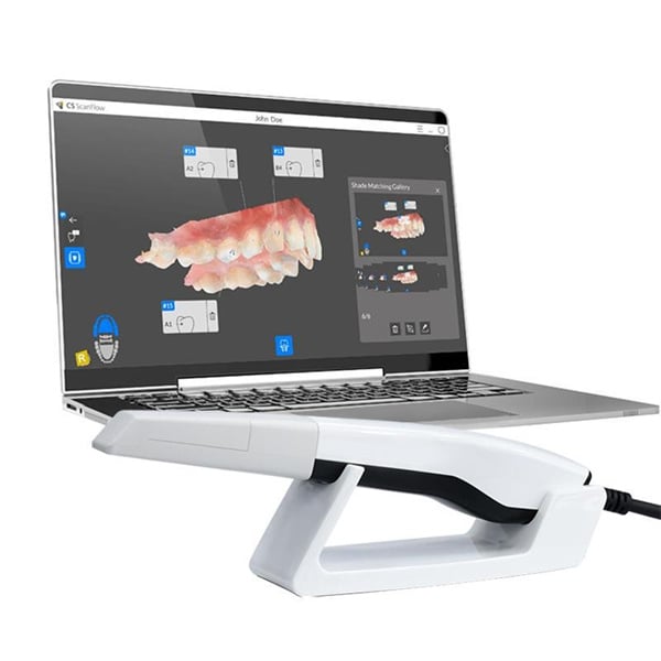 Say Goodbye to Traditional Impressions with a Digital Teeth Scanner