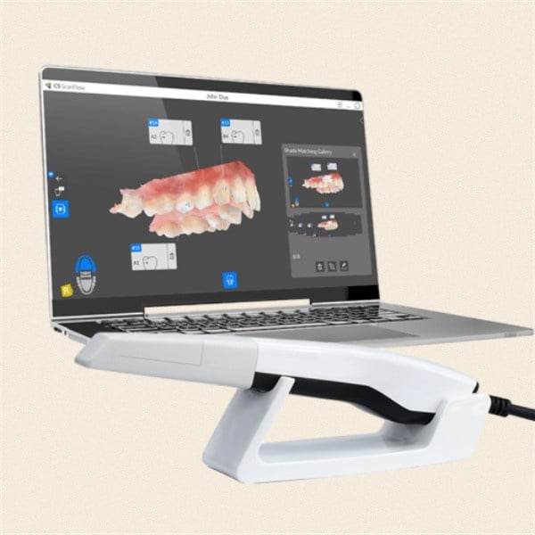 The Benefits of Dental 3D Scanners