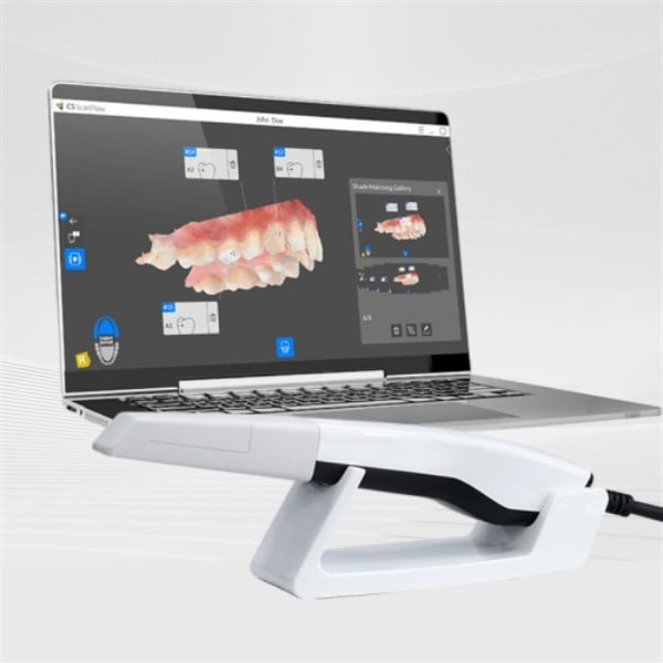 How to Choose the Right Intraoral Scanner for Your Dental Practice
