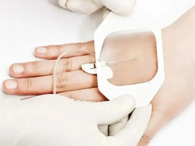 แผ่นปิดแคนูลาให้สารน้ำแบบโพลียูรีเทน: การป้องกันที่กันน้ำสำหรับการดูแลผู้ป่วยวิกฤต