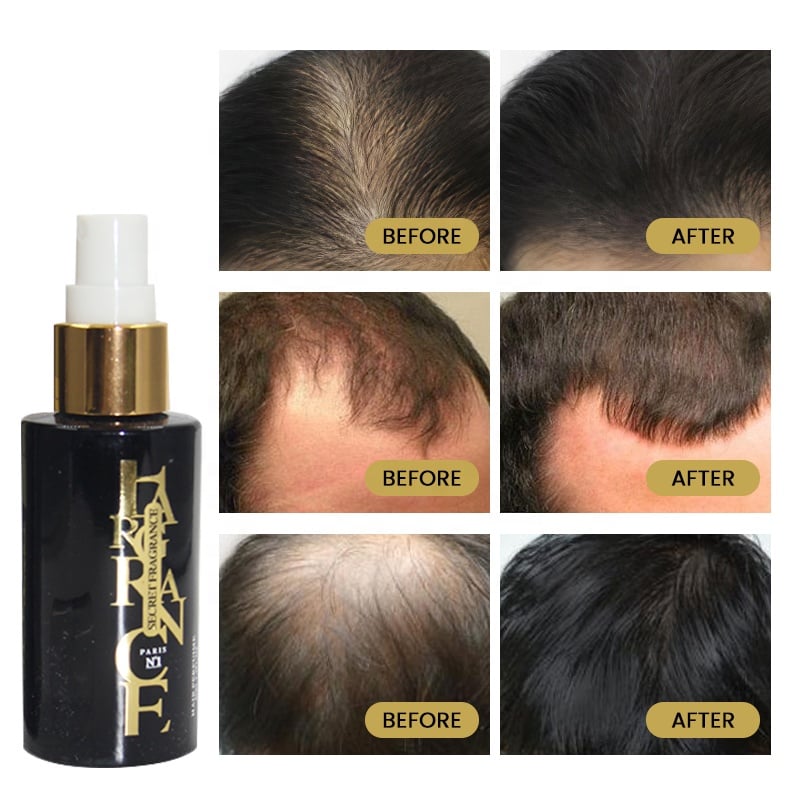 Private Label Organic S and F Anti Hair Loss Product Hair Regrowth Treatment Fast Hair Growth Serum Oil For Black Women details