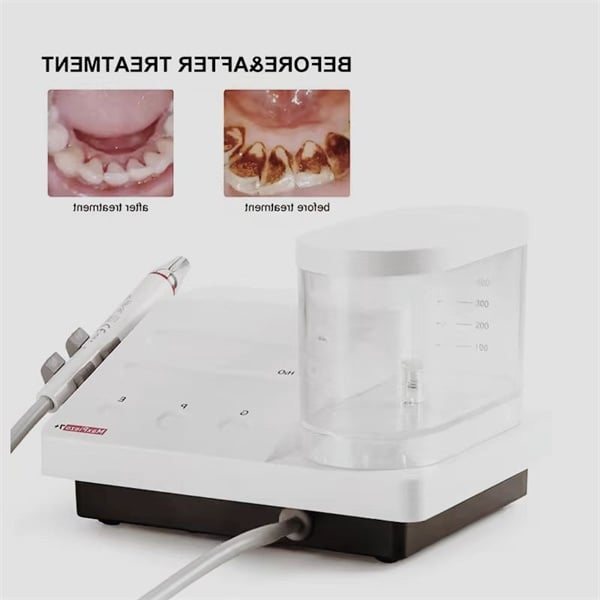 Bid Farewell to Tartar Build-up with an Electric Tooth Scaler
