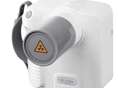 How Dental Xray Unit & Sensor Help in Detecting Early Dental Diseases