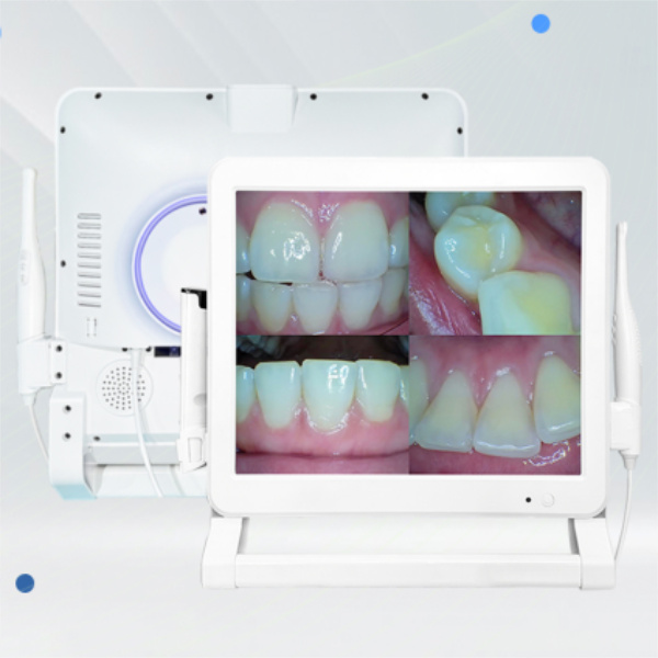 Enhancing Patient Care with Intraoral Cameras