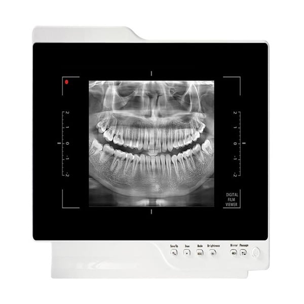 Experience True Vision with Camera Teeth