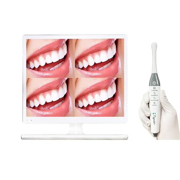 Intra oral cameras ensure a more accurate diagnosis and treatment.