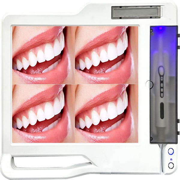 Maximizing Efficiency with Intraoral Cameras