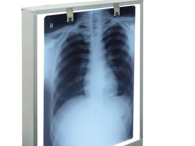Best 6 Wholesale Suppliers for x ray viewer in Indonesia