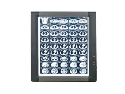 How to Choose the Right X-Ray Viewer for hospital?