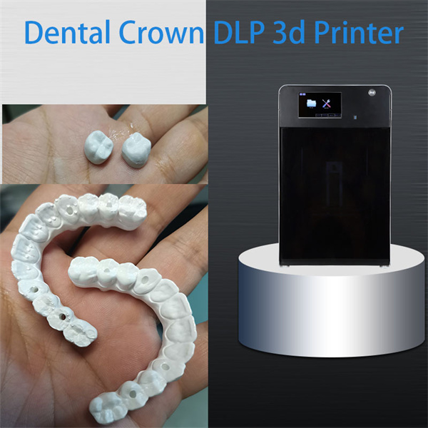 A revolution in dental restoration techniques
