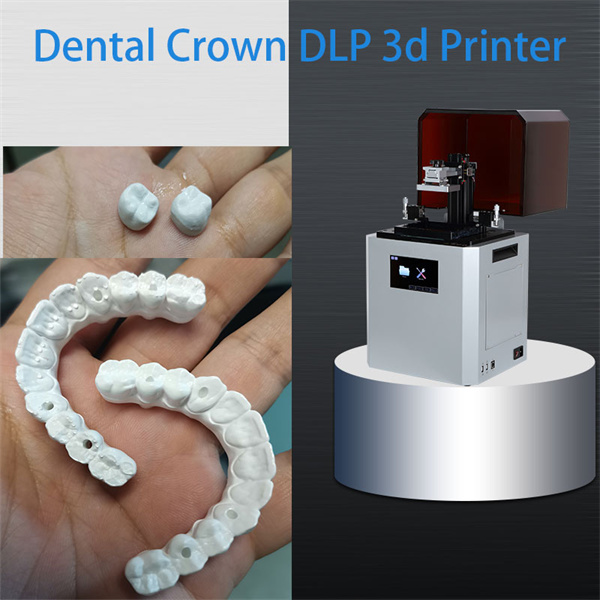 Precision and Efficiency with Dental Resin 3D Printing