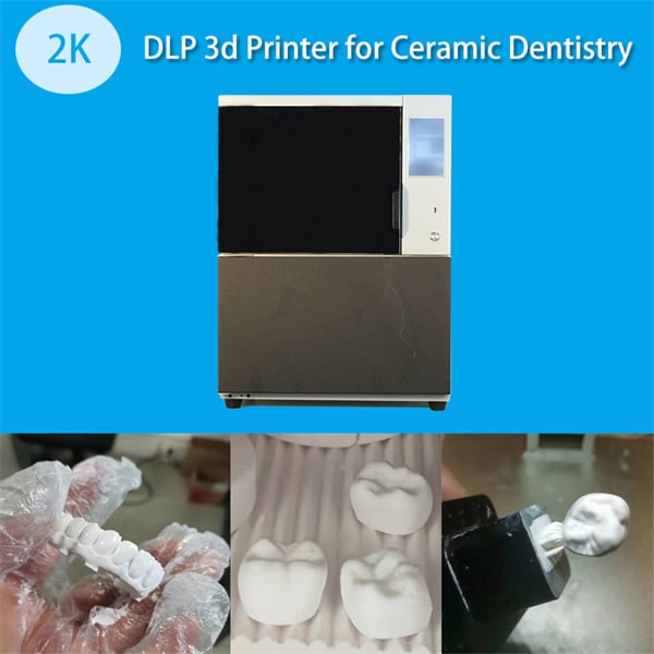 L'imprimante 3D la plus rapide pour des restaurations dentaires de haute qualité