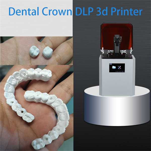 Customizable 3D dental resin solutions for tailored dental treatments