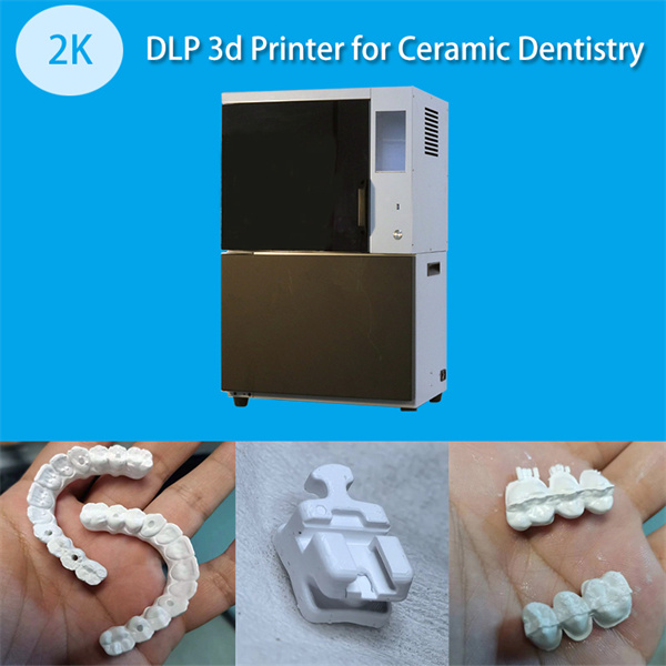 Cost-effective and Customized Dental Solutions with 3D Printing