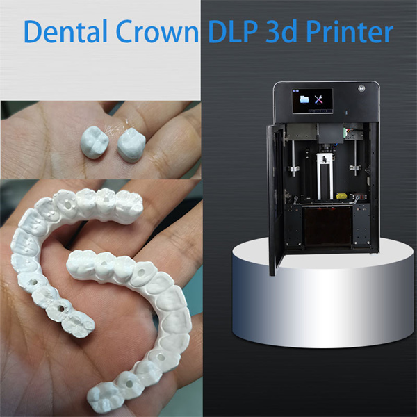 Advantages of dental resin 3D printing