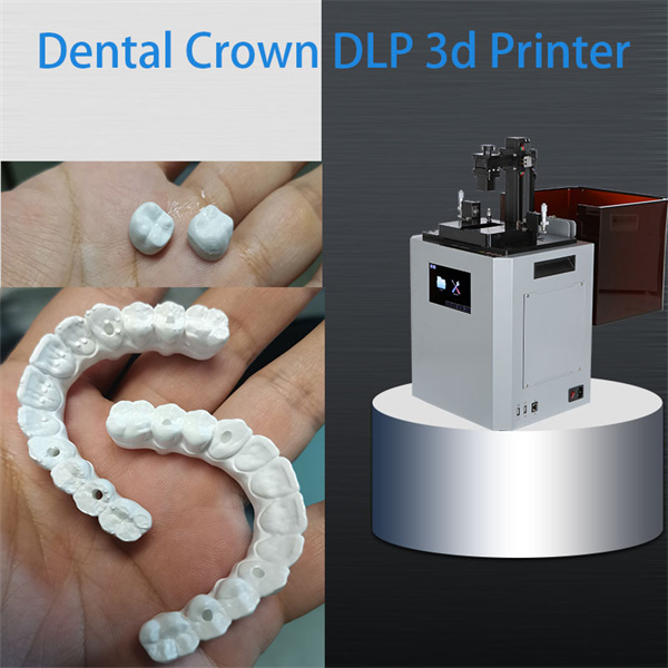 Versatile 3D dental resin suitable for a wide range of dental applications