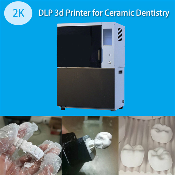 Streamlined Production with Budget-Friendly Dental 3D Printers