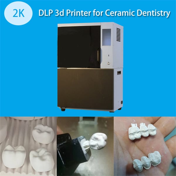 The Benefits of 3D Printing for Customized Dental Appliances