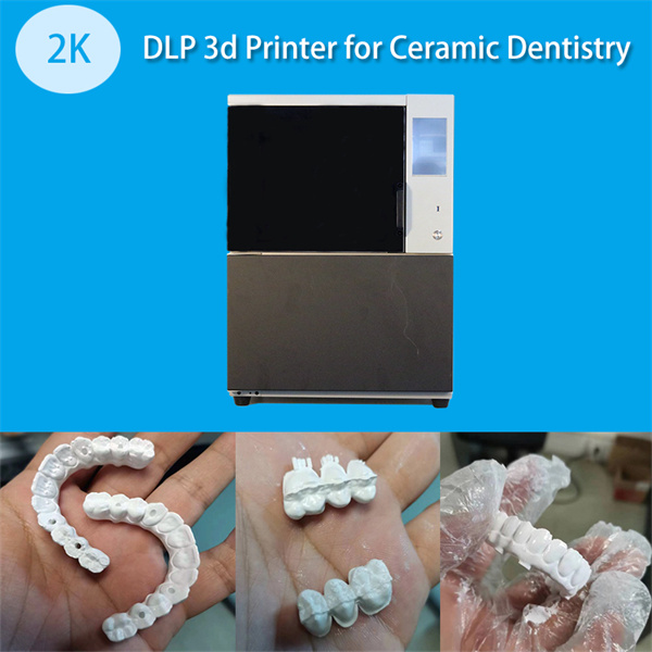 The Advantages of 3D Printing in Dental Laboratories