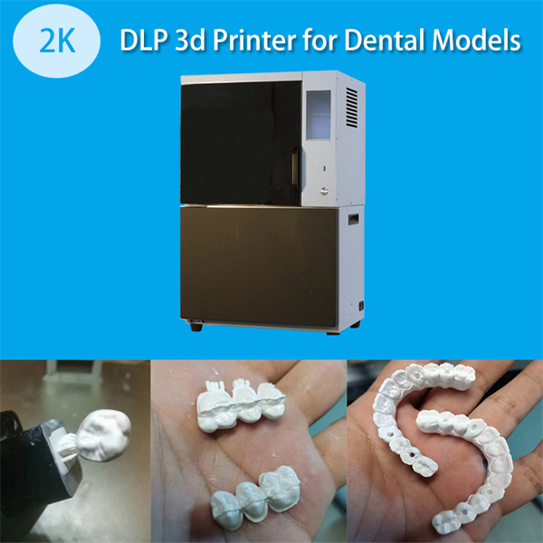 Improving Dental Results with 3D Printing