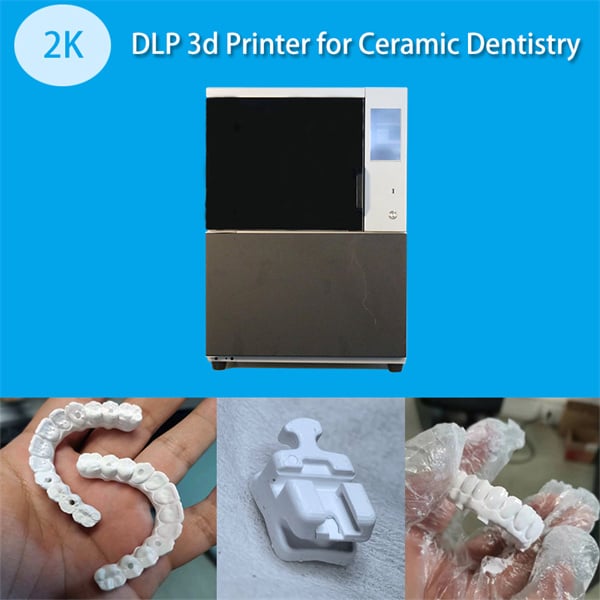 The Precision of Dental Printing - A Game-Changer for Implantology