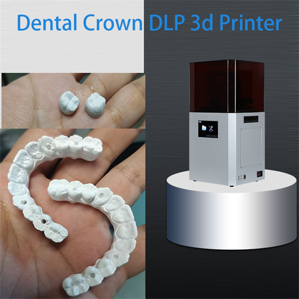 Breaking down the components of dental resin for 3D printing