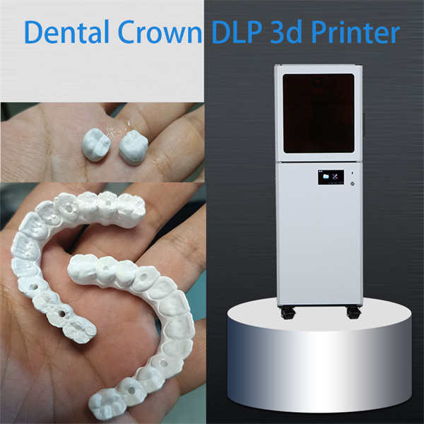 The Benefits of Using a Dental Resin Printer for In-House Production