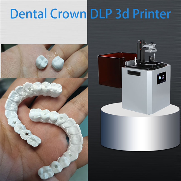 Achieving Perfect Dental Impressions with 3D Resins