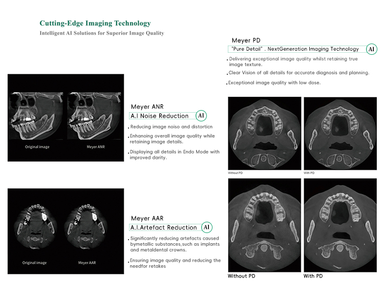 Dental X Ray Machine 3d Opg Dental Panoramic X-ray Machine Cbct Dental Xray Sensor Digital X-ray factory
