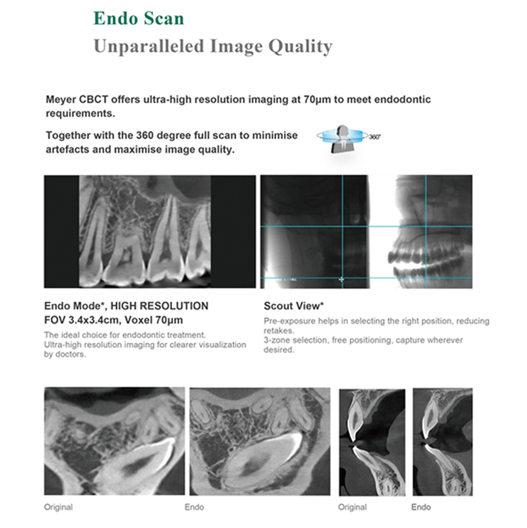 Dental X Ray Machine 3d Opg Dental Panoramic X-ray Machine Cbct Dental Xray Sensor Digital X-ray manufacture