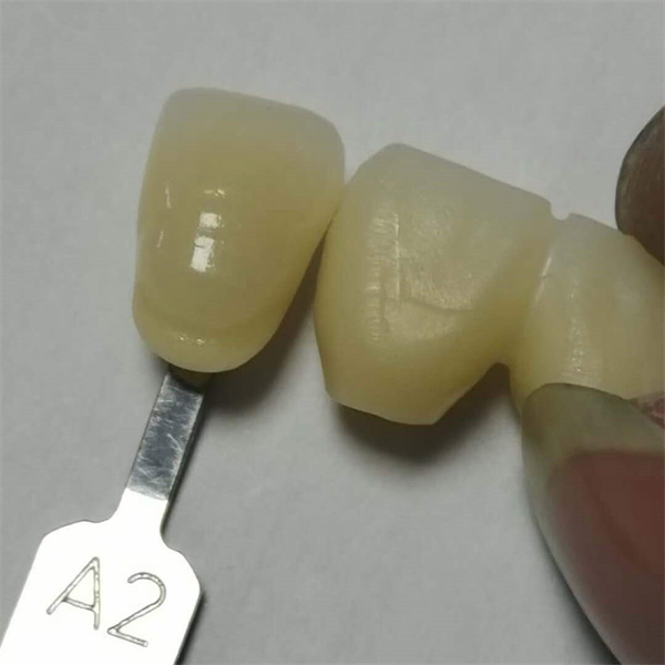 What makes our dental zirconia block stand out from the competition