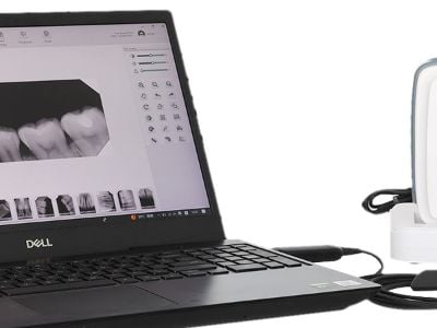 Últimas tendencias en sensores dentales digitales de rayos X para la reducción de radiación