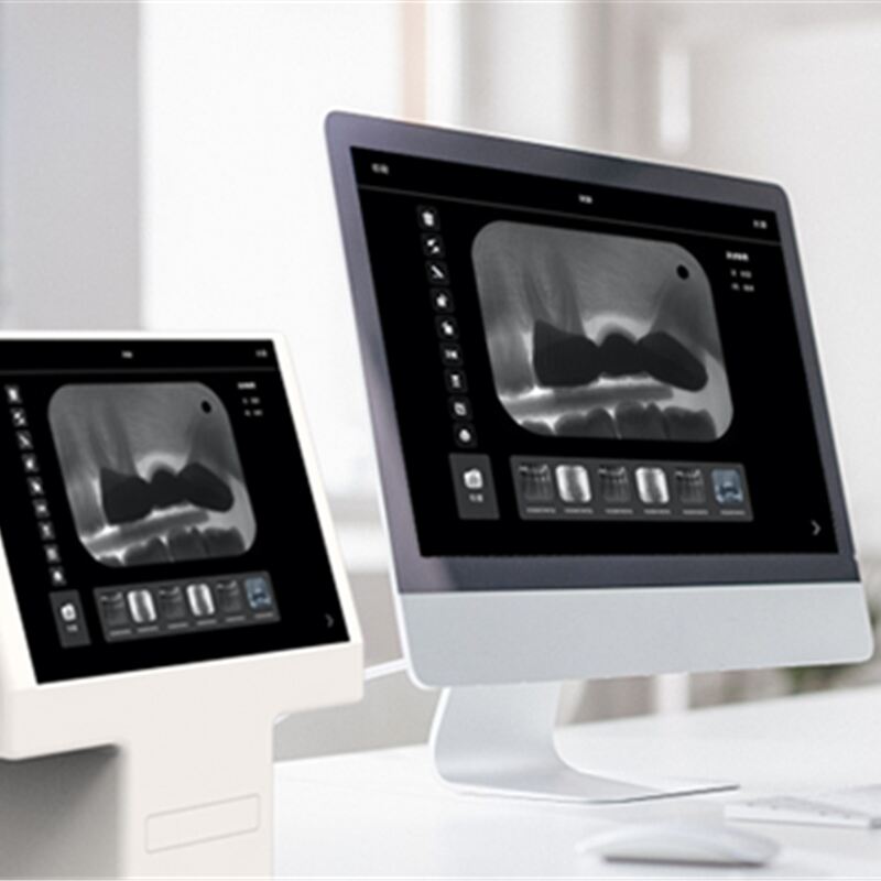 Dental X Ray Digital Sensors vs Film: Cost-Saving Benefits